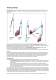 RHEA depower system - Advance Kites
