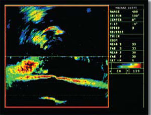 Boat sonar - SS395 Series - Wesmar