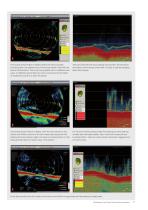 Catch Monitoring Systems - 11