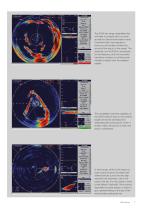 Sonars-7